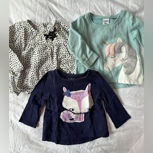 Baby Tops Set